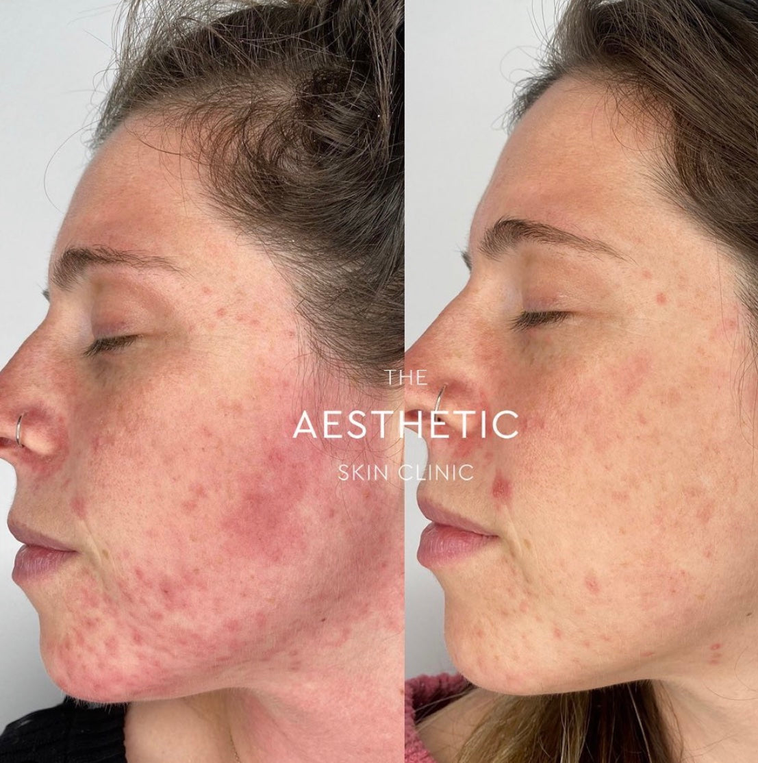 Results – Theaestheticskinclinic